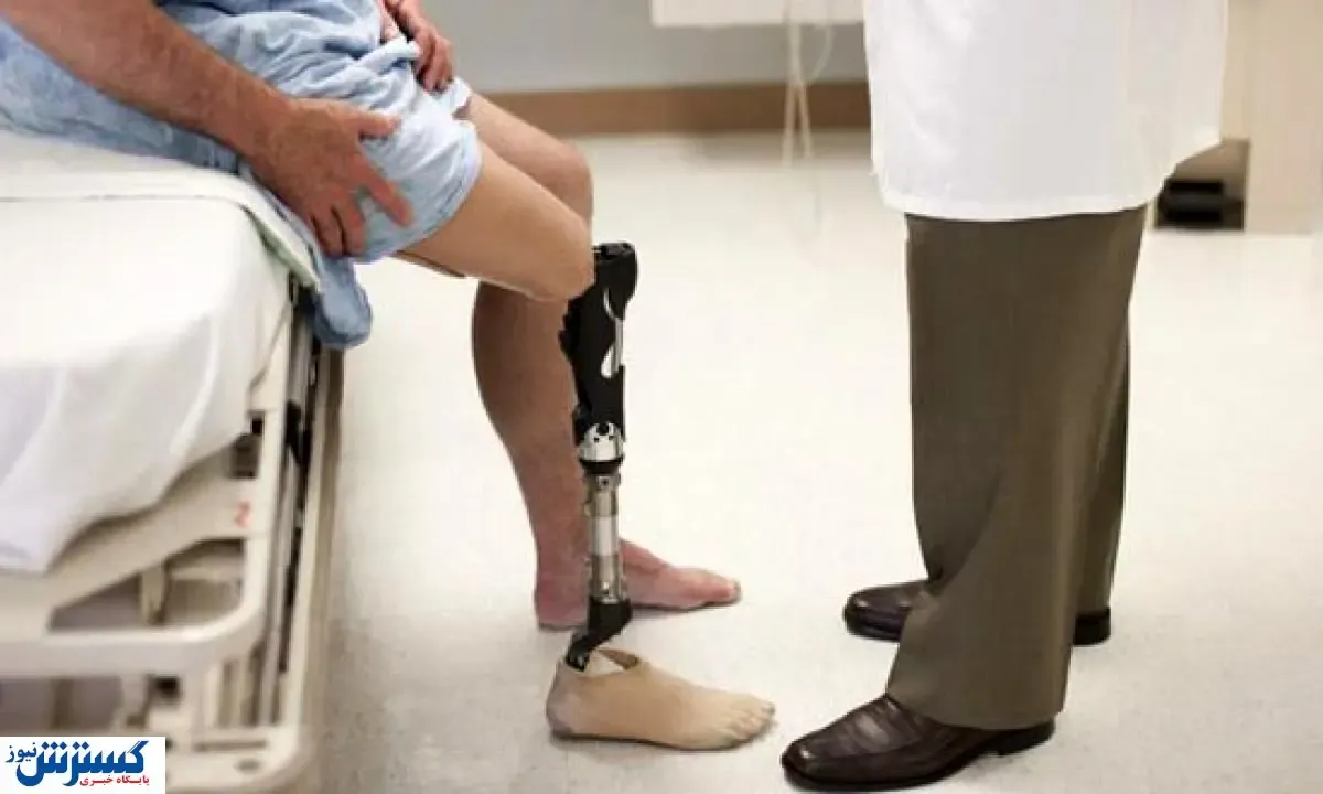 صندوق بیماران صعب العلاج افراد قطع عضو را تحت پوشش بیمه بیماران خاص پذیرفت