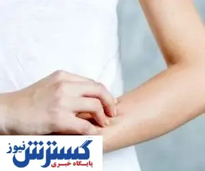 خارش پوست یعنی به این بیماری مبتلا شده اید!