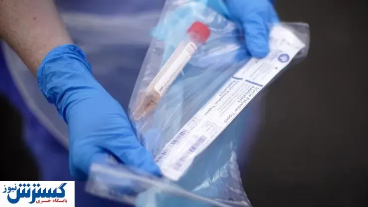 هزینه تست کرونای انگلیسی چقدر است؟