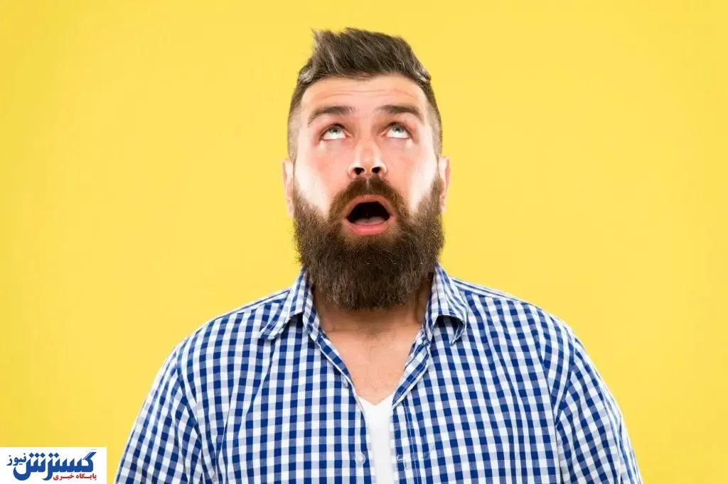 پیش بینی هزینه کاشت مو در سال ۱۴۰۱