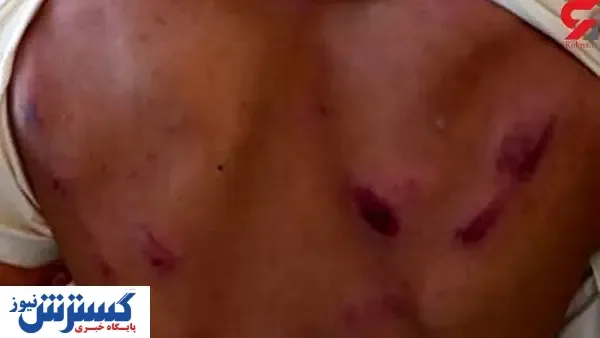 ضرب و شتم شدید دانش آموز سیستانی توسط یک معلم+ عکس