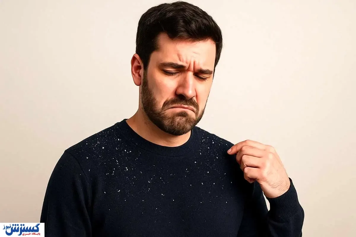 چرا بعد از شستن مو، شوره سر بیشتر می‌شود؟