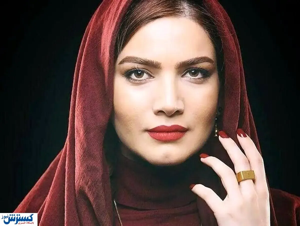 تغییر چهره جذاب خانم طناز سینما و تلویزیون | عمل زیبایی چهره او را زمین تا آسمان تغییر داد! +عکس