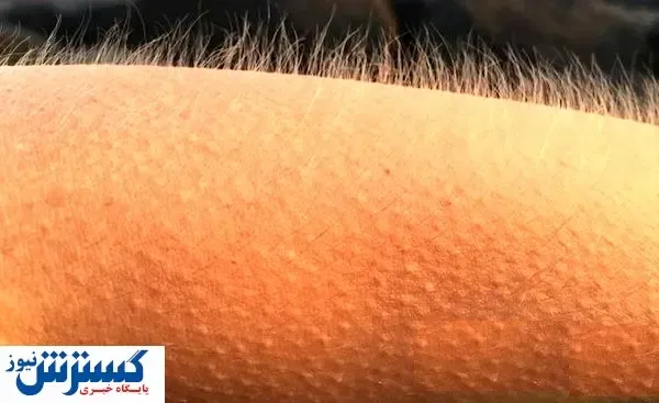 چرا بدنمان مورمور می شود؟