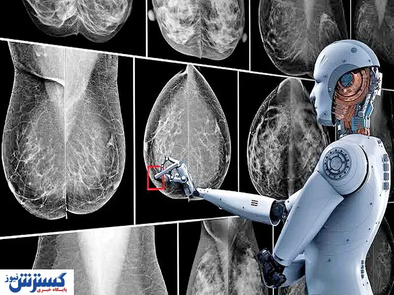 هوش مصنوعی همانند رادیولوژیست درست عمل می‌کند؟