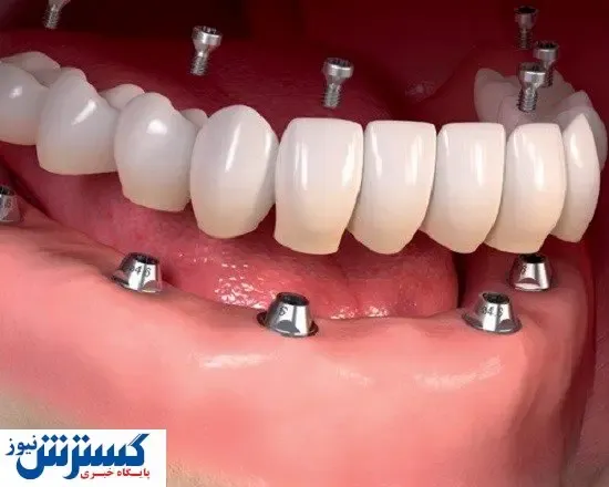 خدمات دندان پزشکی کلینیک دندان پزشکی دایادنت