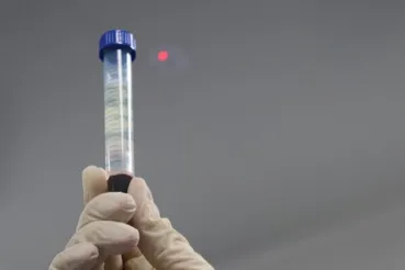 انقلاب پزشکی در جهان / خون مصنوعی انسان جاودانه را متولد می‌کند؟