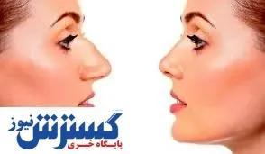 قبل از عمل بینی حتما این کار را انجام دهید