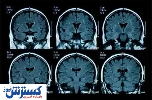 عوامل دستکاری گزارش ‌های MRI دستگیر شدند!