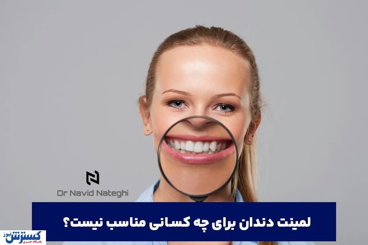 لمینت دندان برای چه کسانی مناسب نیست؟ راهنمای جامع از دکتر ناطقی