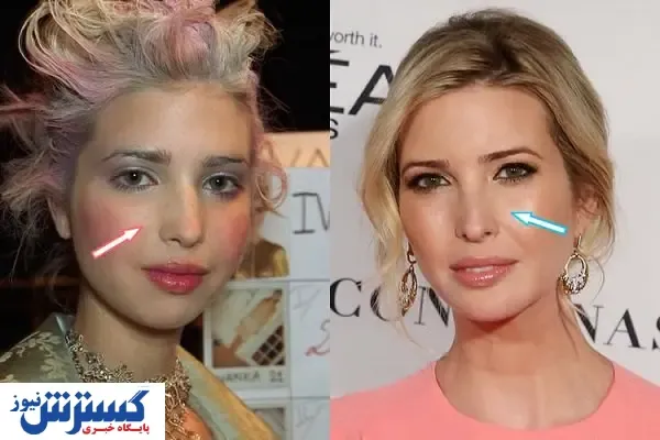 ماجرای دماغ عملی ایوانکا ترامپ + عکس