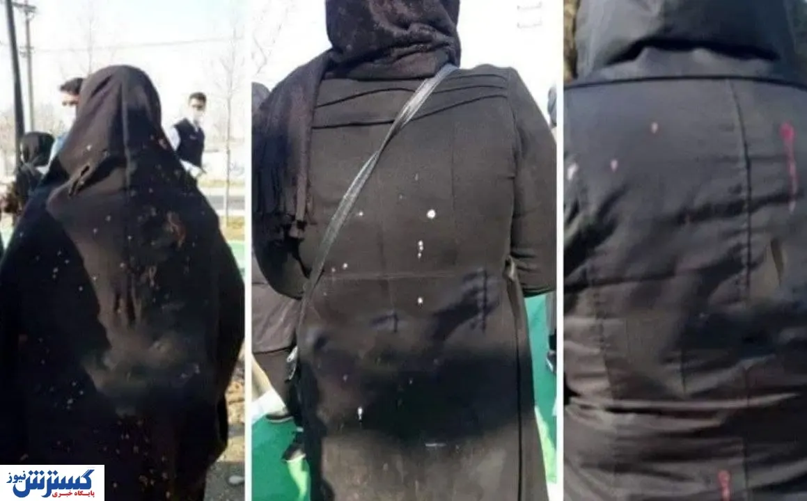 اسیدپاشی بر صورت زنان تمامی ندارد