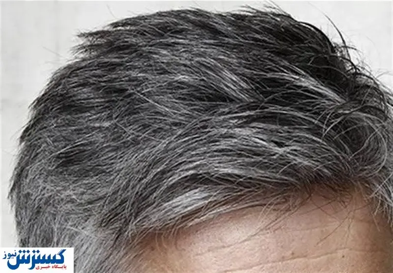 شپش از کجا می آید؟