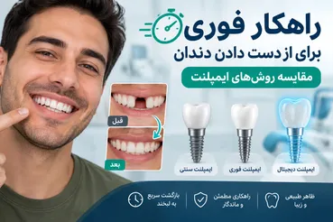 مقایسه روش‌های ایمپلنت دندان: کدام روش برای شما مناسب‌تر است؟
