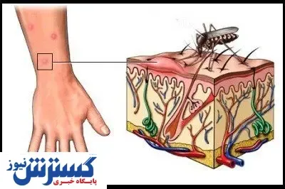 هشدار / این بیماری جان شمارا می گیرد