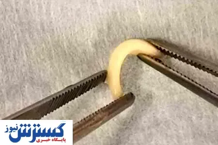 خبر خوش درباره ترمیم بینی