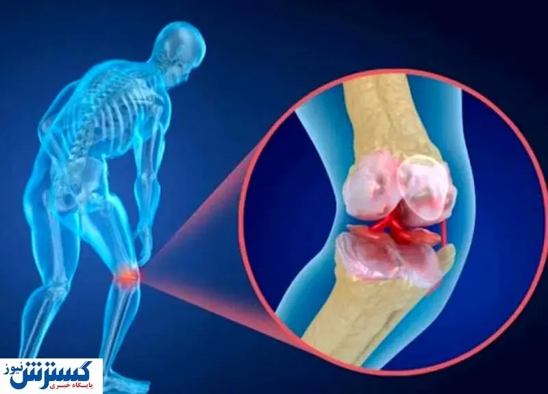 علائم هشدار دهنده پوکی استخوان