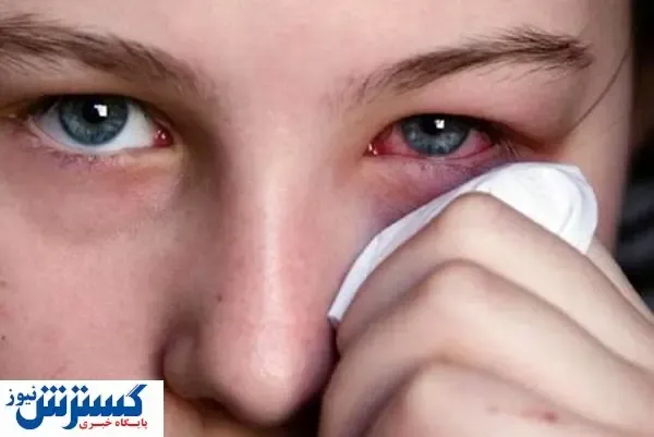 کرونا بر روی بینایی تاثیر می‌گذارد؟
