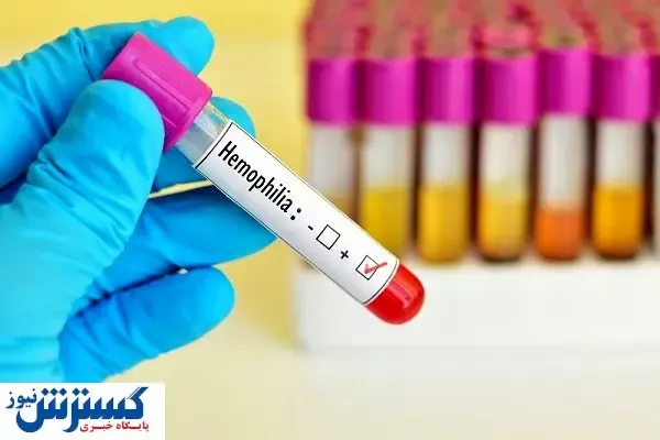 ثبت ۱۳ هزار مبتلا به هموفیلی در ایران