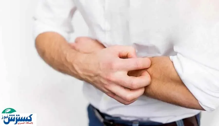 ۴ تغییر پوستی که نشان می‌دهد کبد بیماری دارید