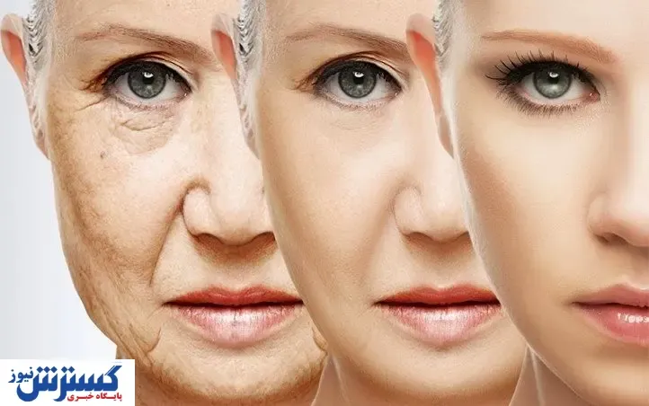 چطور چین و چروک صورت را از بین ببریم؟