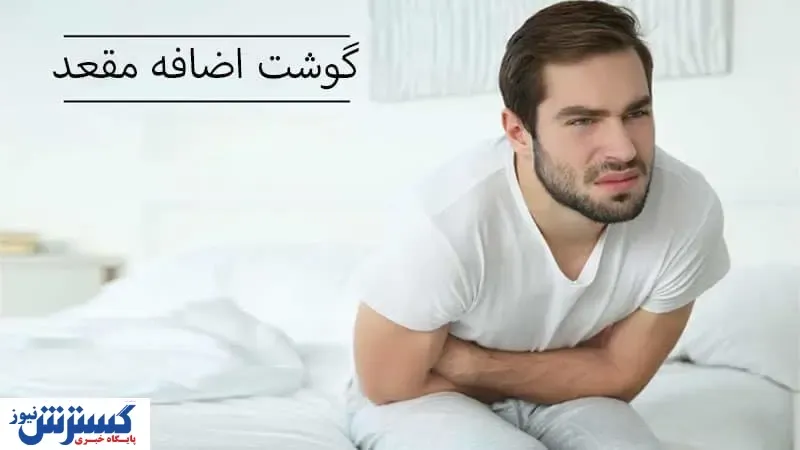گوشت اضافه یا زائده مقعد و راه‌های درمان