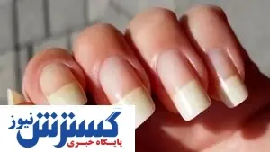 با این روش ها ناخن های محکم و سالم داشته باشید
