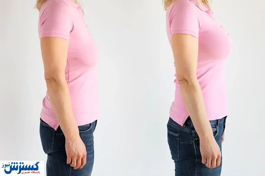 انواع روش های جراحی سینه و عوارض آن ها