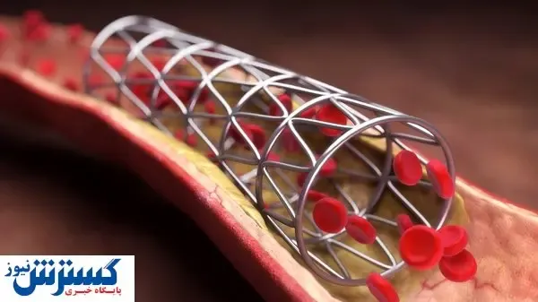 خوش به حالِ بیماران قلبی شد