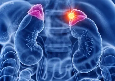 کورتیزول بالا متهم اصلی چاقی، بی‌خوابی و عصبانیت / راه درمان پیدا شد