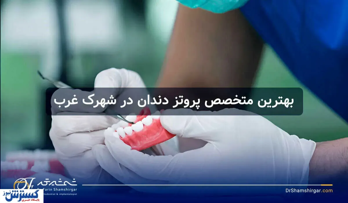 آشنایی با بهترین متخصص پروتز دندان در شهرک غرب