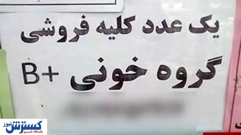 قیمت عجیب کلیه در بازار ایران (۱۴۰۰)