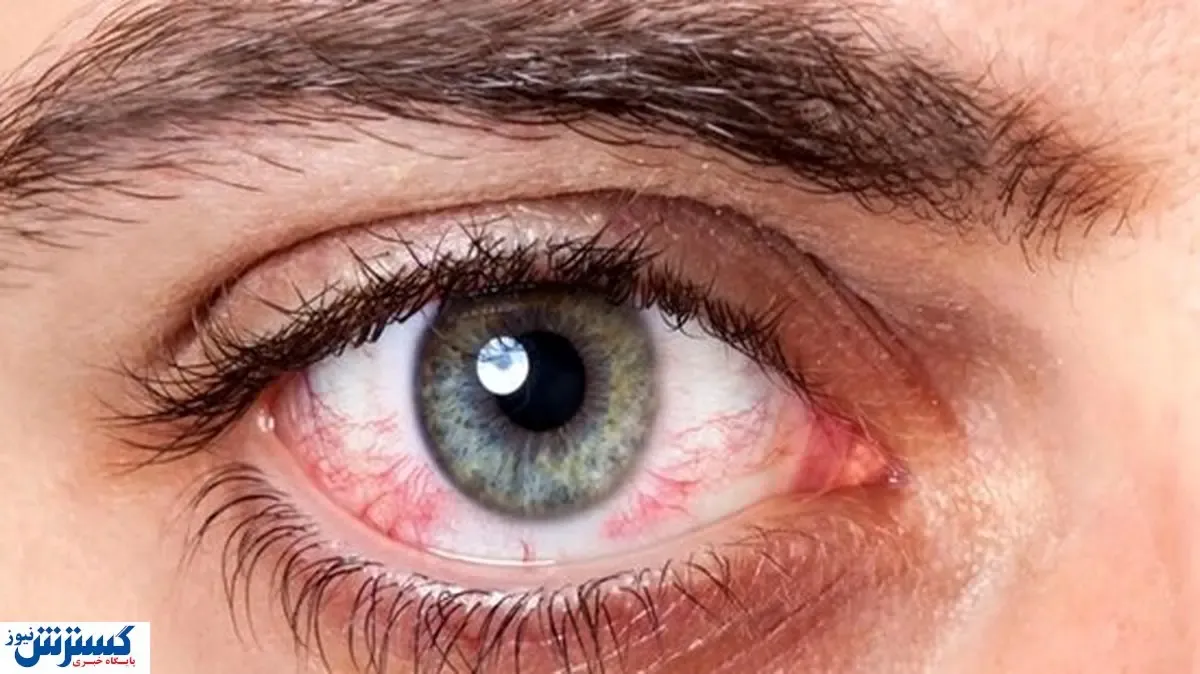 کدام مواد غذایی باعث تقویت چشم میشود؟