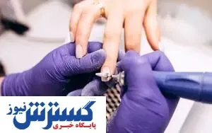 خبر بد برای علاقمندان کاشت ناخن / منتظر این بیماری ها باشید