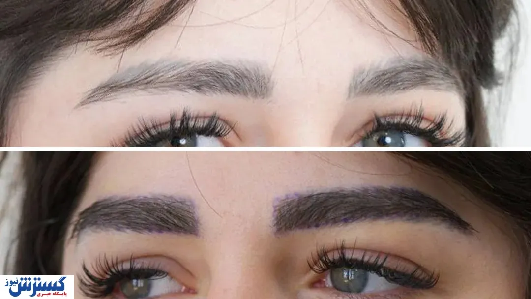 نتیجه کاشت ابرو طبیعی