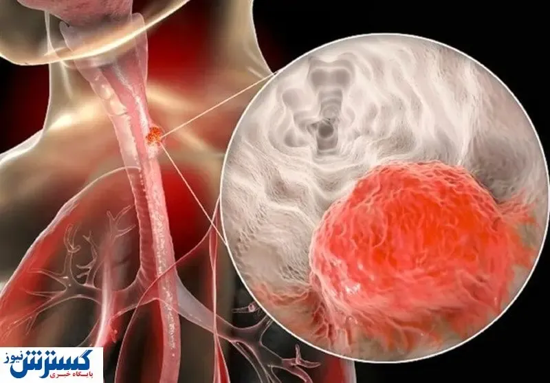 تولید کیت مانیتورینگ سرطان توسط جهاد دانشگاهی