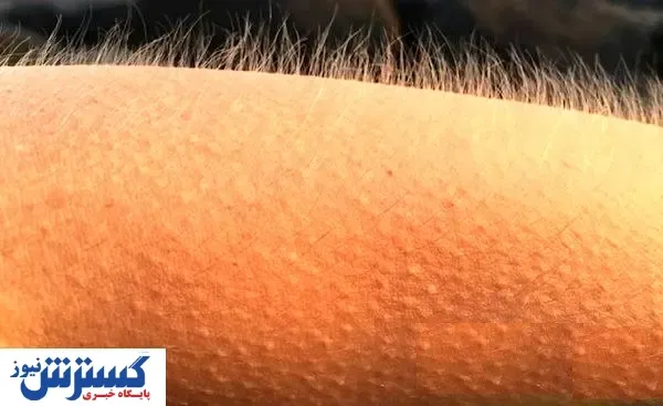 از علت تا درمان کبودی خارش دار