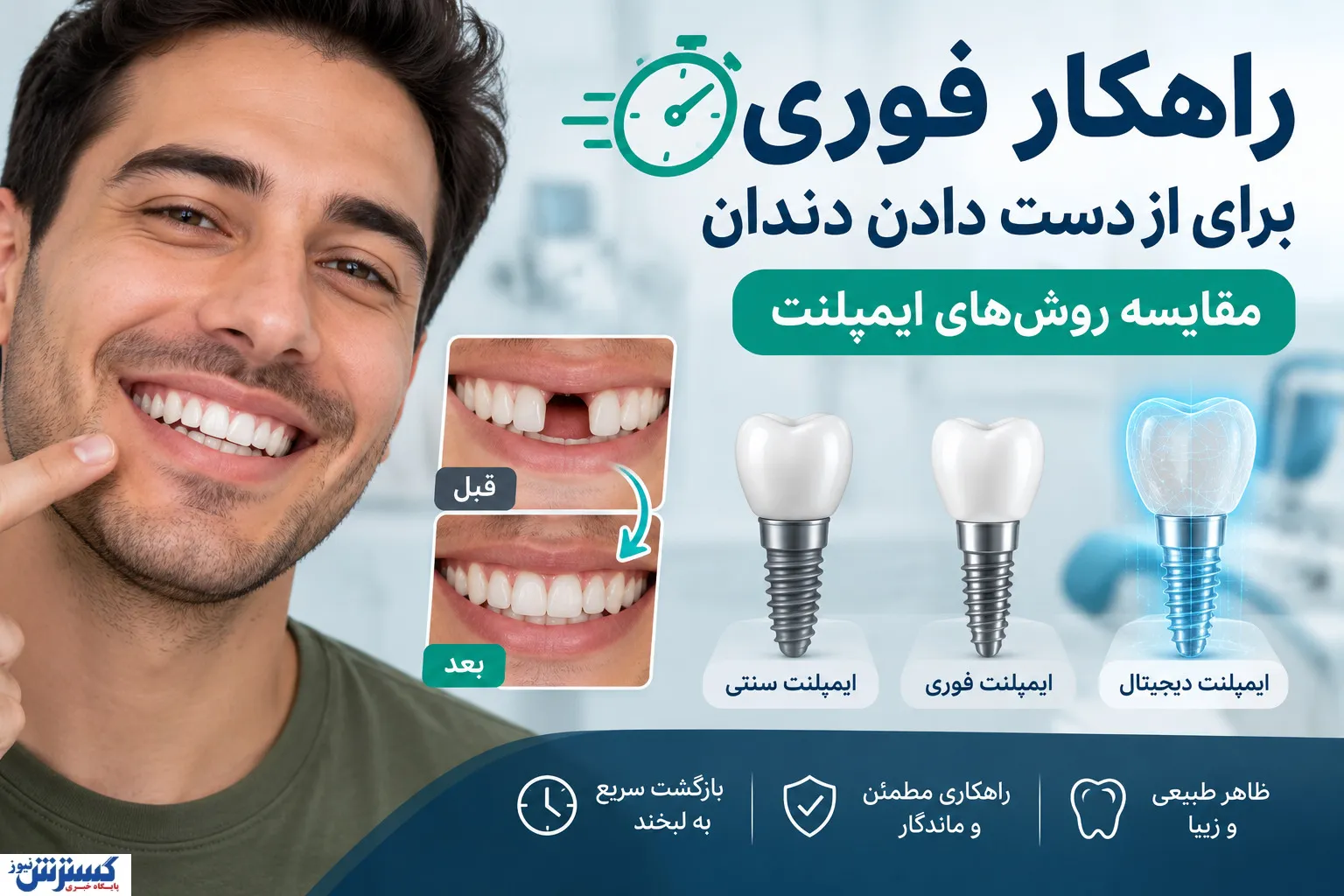 مقایسه روش‌های ایمپلنت دندان: کدام روش برای شما مناسب‌تر است؟