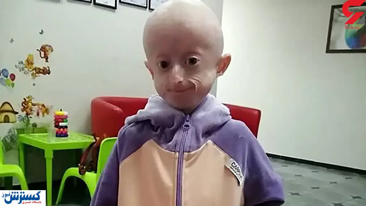 عجیب‌ترین کودک دنیا؛ ۱۰ سال نه ۱۰۰ سال! / عکس