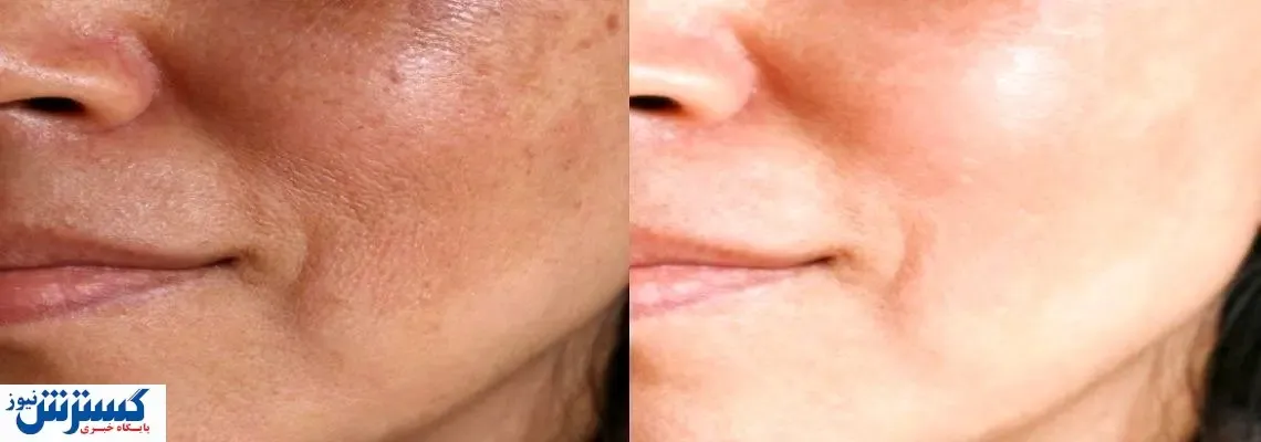 چگونه بهترین دکتر پوست را پیدا کنیم؟