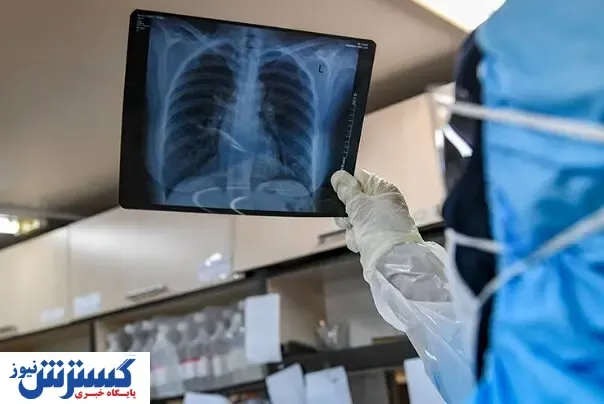 کرونا با ریه های شما چه می کند؟