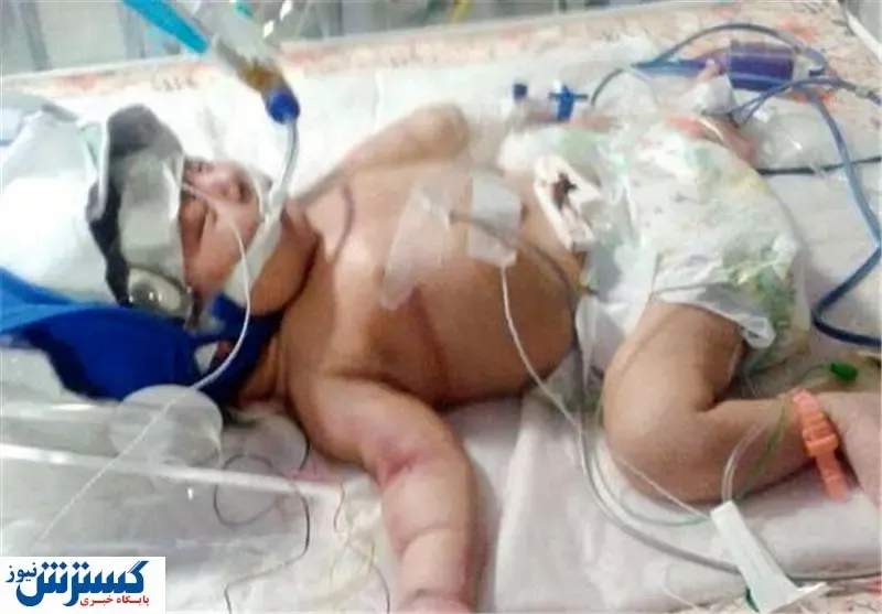 فوت تاسف برانگیز جنجالی نوزاد در بیمارستان نهاوند