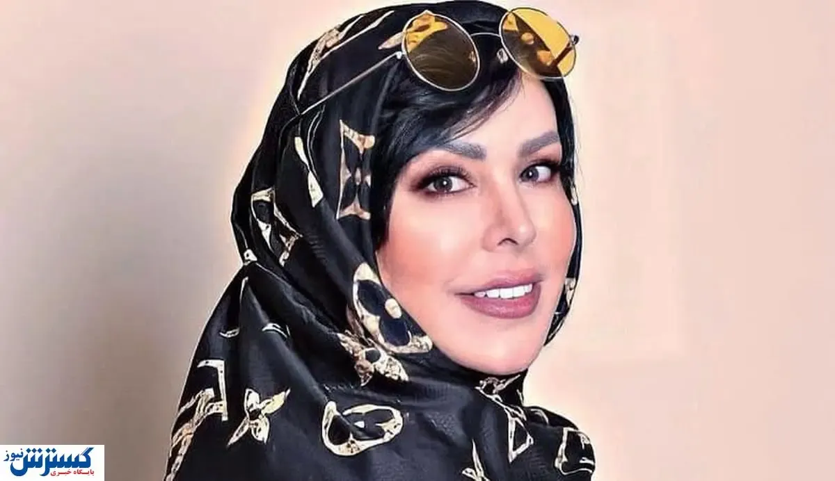 تغییر چهره جنجالی فلور نظری | مهاجرت به او ساخت! +عکس