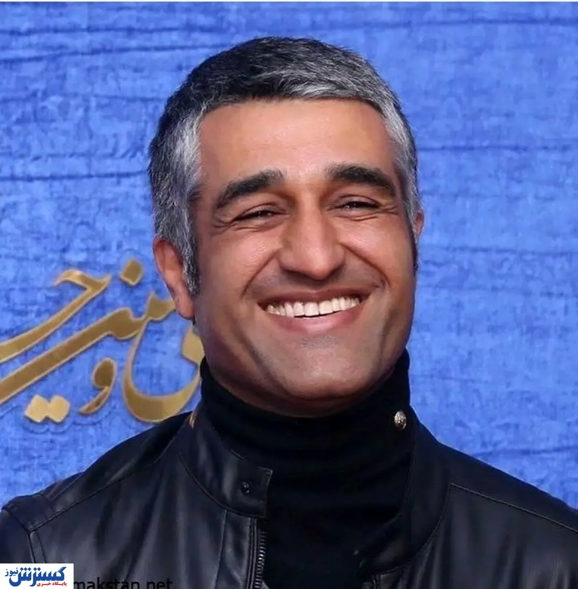 تغییر چهره پژمان جمشیدی+عکس
